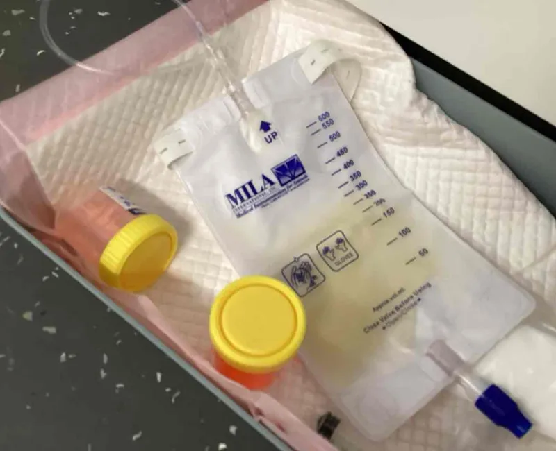 Urinary diagnosis