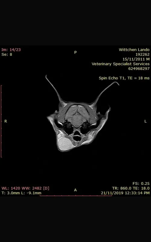 Ultrasound result
