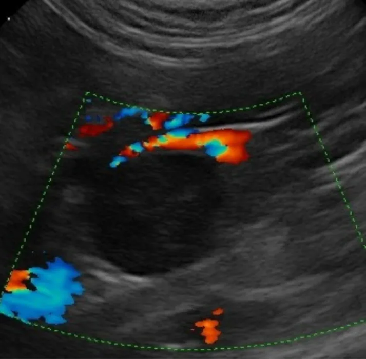 Colour Doppler ultrasound showing the feline adrenal region and surrounding blood vessels
